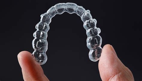 Why do I need to wear a retainer after braces?