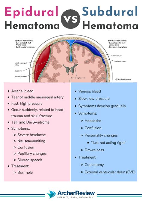 Archer Epidural Hematoma vs Subdural Hematoma Cheat Sheet - Arterial ...