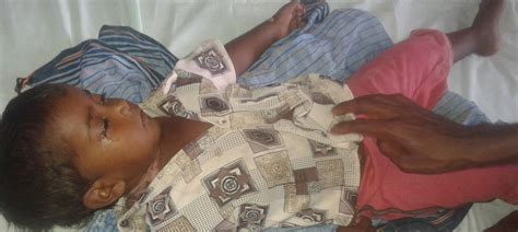 Thirty children in Odisha’s Malkangiri have died of Japanese ...