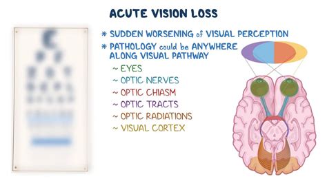 Approach to acute vision loss: Video & Meaning | Osmosis