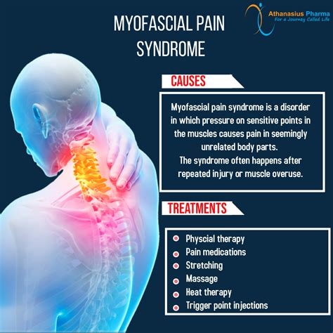 Chronic Myofascial Pain Syndrome Symptoms