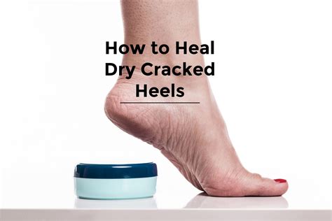 How to Heal Cracked and Dry Heels - Curious Bluebird