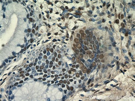 ESR2 Beta 3 antibody (55441-1-AP) | Proteintech