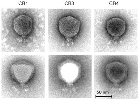 Novel N4-Like Bacteriophages of Pectobacterium atrosepticum