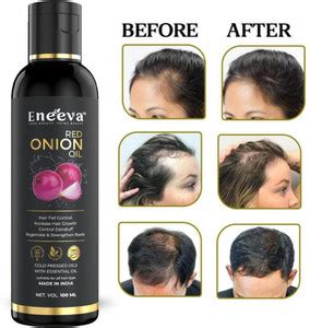 eneeva Red Onion Hair Growth Oil Hair Oil - Price in India, Buy eneeva ...