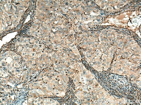 PKLR antibody (22456-1-AP) | Proteintech