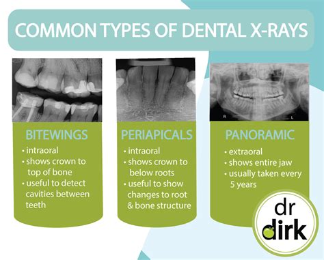 Types of Dental X-Rays At Our Calgary Dentist Office - Advance Your Health Dental - Dr. Dirk ...