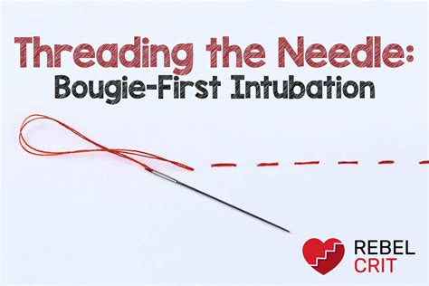 Threading the Needle: Bougie-First Intubation - REBEL EM - Emergency ...