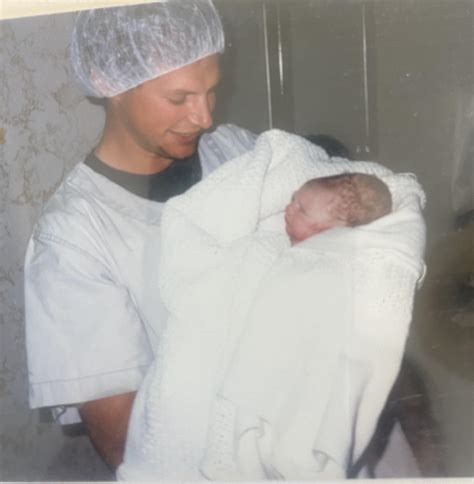 Cone Head Baby Before And After at Nicholas Warrior blog