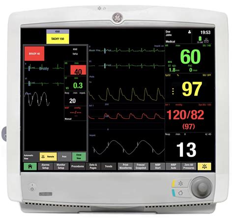 GE Carescape B650 Patient Monitor | Auxo Medical