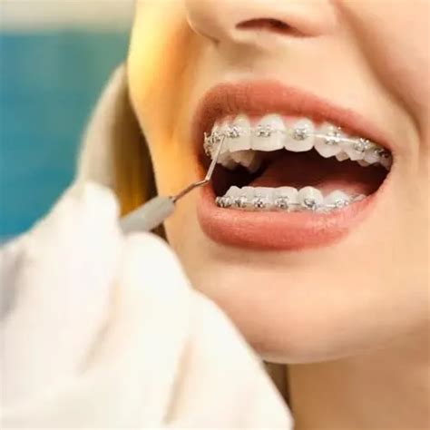 Best Dentist in Dwarka Sector 6 | Best Dental Clinic in Dwarka | Best ...