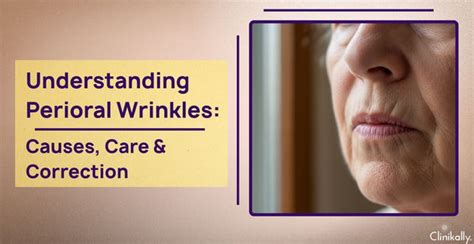 Wrinkles Around The Mouth: Causes, Fillers & Treatments Guide
