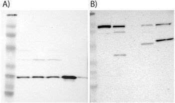 Prestige Antibodies® Powered by Atlas Antibodies in Western Blot ...