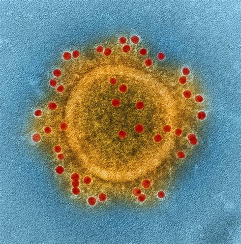 Mers Disease Ear at Larry Webb blog