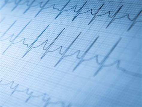 Non-Invasive Cardiology 的图像结果