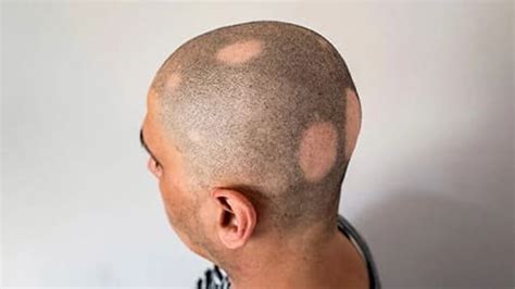 Silk Skin Station - Transform Your Skin, Transform Your Life - Best ...