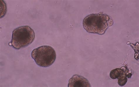 Image result for Clam Level 2