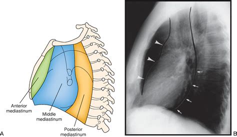 Radiology of the Thorax - Clinical Tree