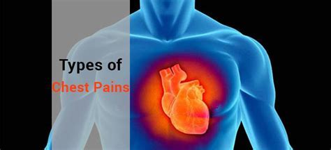 types of chest pain | enjoyable card gaming experiences Android IOS V- 3.98