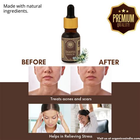 Eucalyptus Essential Oil 15 ml – Organicos India Store