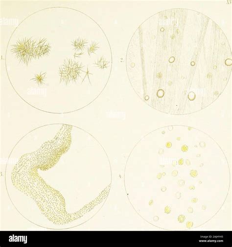White Mucus In Urine