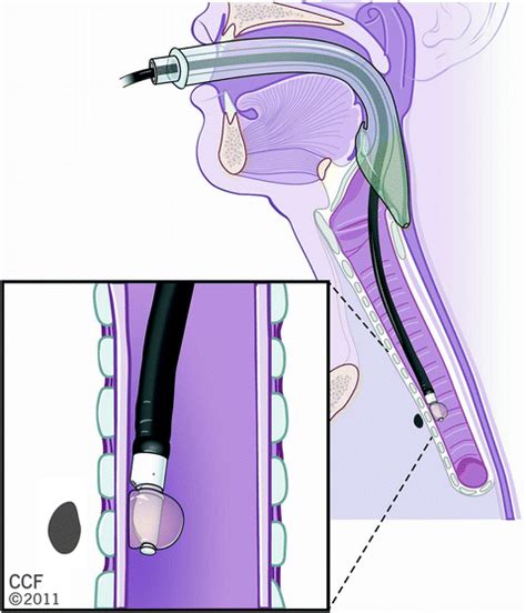 Image result for Patient Bad Example