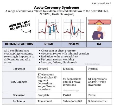 What is Acute Coronary Syndrome (ACS)? This is a general term that encompasses three conditions ...