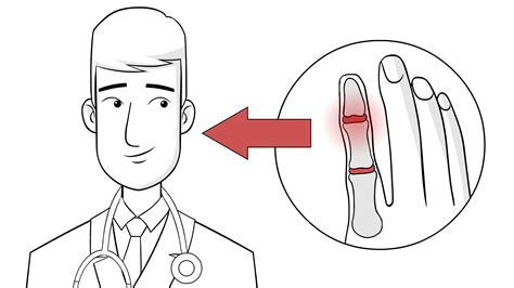 How to Treat a Jammed Finger: Home Remedies & Medical Care