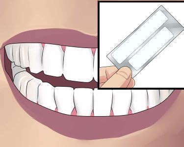 Teeth Cleaning Tutorial 的图像结果