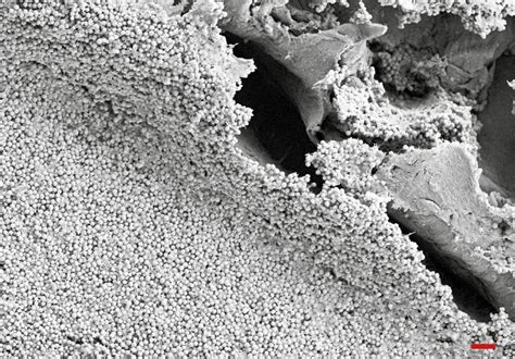 Photodynamische Therapie bei orthopädischen Infektionen - Dermatologie ...