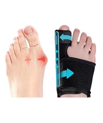 OXYGLOBE 2PCS Corrector, Corrector Toe Straightener Reduce The Bony ...