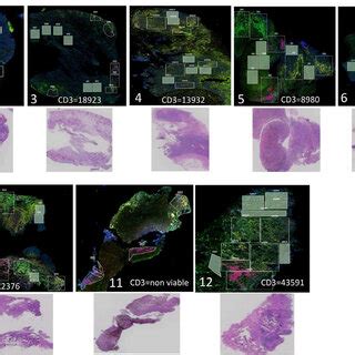 NanoString Spatial Transcriptomics 的图像结果