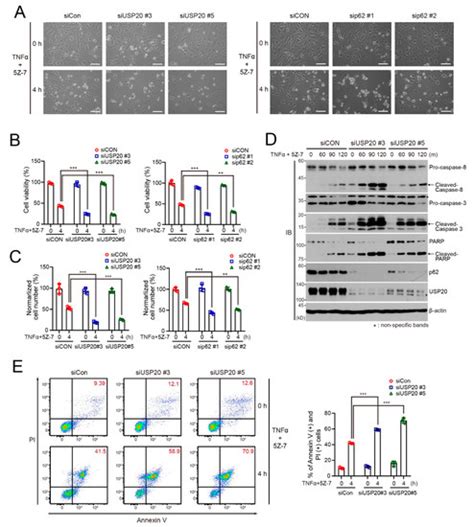 The Deubiquitinating Enzyme USP20 Regulates the TNFα-Induced NF-κB ...