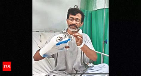Three Fingers Stitched Back, Man Set To Return To Work | Kolkata News ...
