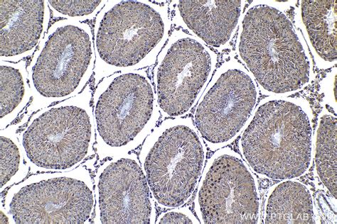 IHCeasy SRGAP1 Ready-To-Use IHC Kit KHC1283 | Proteintech