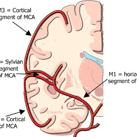 Where Is The Mca Located In The Brain at Liam Threlfall blog