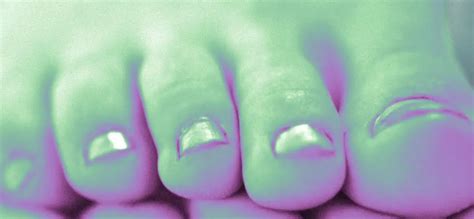 Image result for How File Thick Toenails