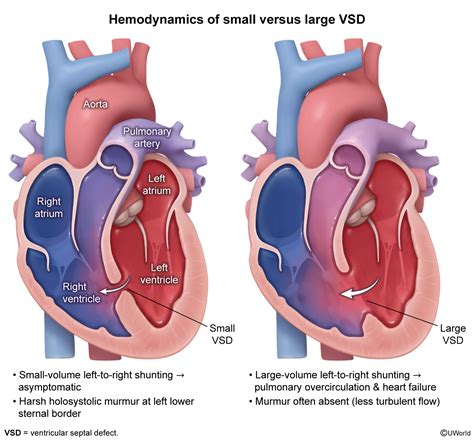 PANCE Blueprint - 2025 Categories, Topic List and PDFs