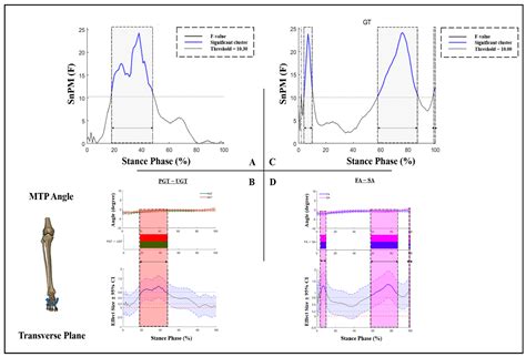 The Effect of Arch Stiffness on the Foot–Ankle Temporal Kinematics ...