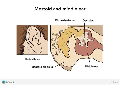 Mastoid Process Ear