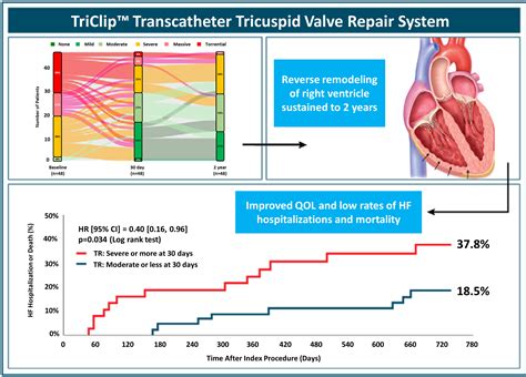 Two-Year Outcomes for Tricuspid Repair With a Transcatheter Edge-to-Edge Valve Repair From the ...