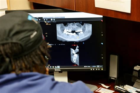 Image result for Tooth Extraction Timeline