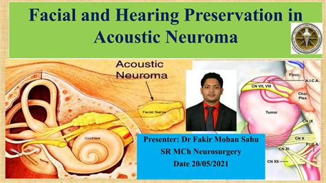 Facial and Hearing Preservation in Acoustic Neuroma Surgery | PPTX