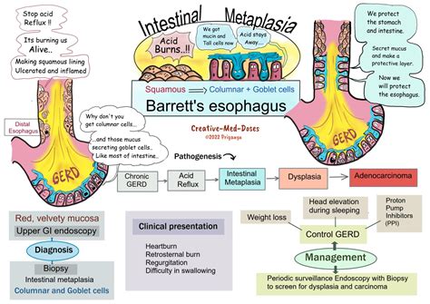 Barrett’s esophagus - Creative Med Doses