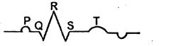 Which of the following is the diagrammatic representation of standard ...