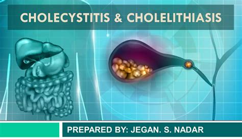 Pathophysiology of Cholecystitis and cholelithiasis | PDF