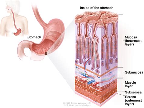 Stages of Stomach Cancer - NCI