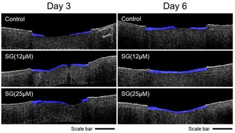 Synthetic Retinoid Seletinoid G Improves Skin Barrier Function through ...