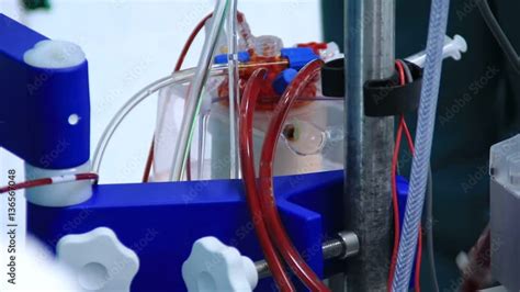 Blood Pumping Machine 的图像结果