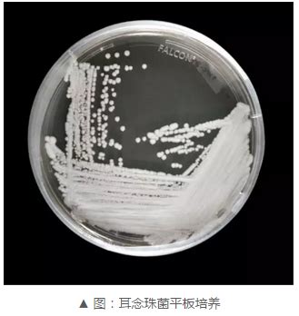 FDA首次批准质谱方法鉴定新型致病菌耳念珠菌 (Candida auris)∷北京鑫汇普瑞科技发展有限公司